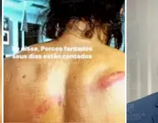 NO ALMEIDÃO: Vereador de João Pessoa é agredido por policiais e diz que vai pedir esclarecimentos ao comandante da Polícia