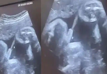 Bebê faz xixi durante ultrassom e vídeo surpreende a web