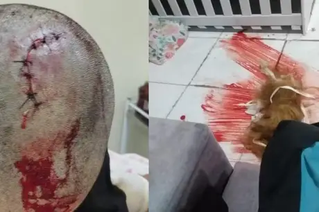 Preso homem suspeito de espancar, torturar e raspar cabelo da ex-esposa, na Paraíba